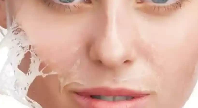 Gözeneklerden Yağ Çıkması ve Genişleyen Gözenekleri Kontrol Altına Alma Yöntemleri