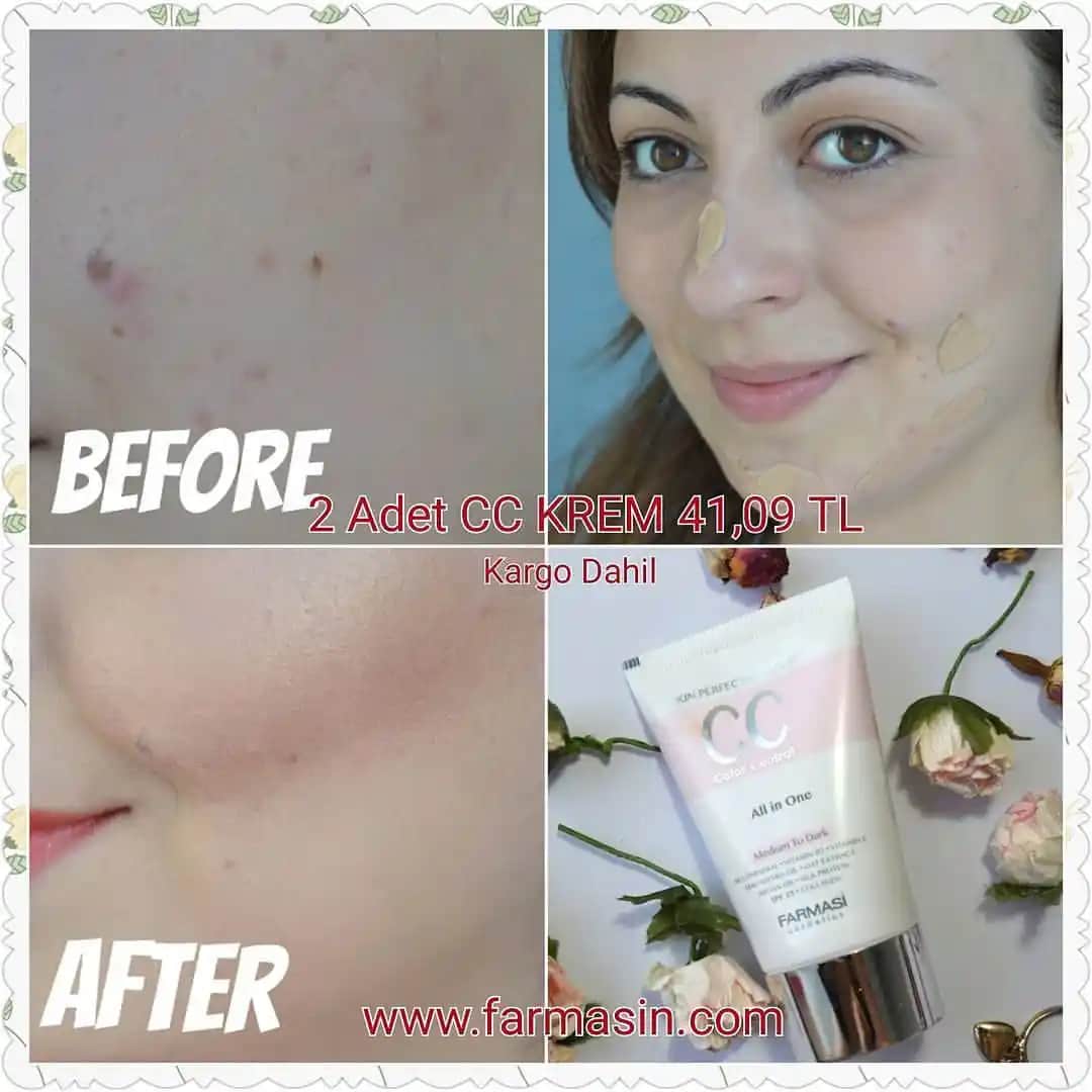 Gözenekleri Kapan Kremi Seçimi ve Kullanımıyla Daha Sıkı Cilt Bakımı Rehberi