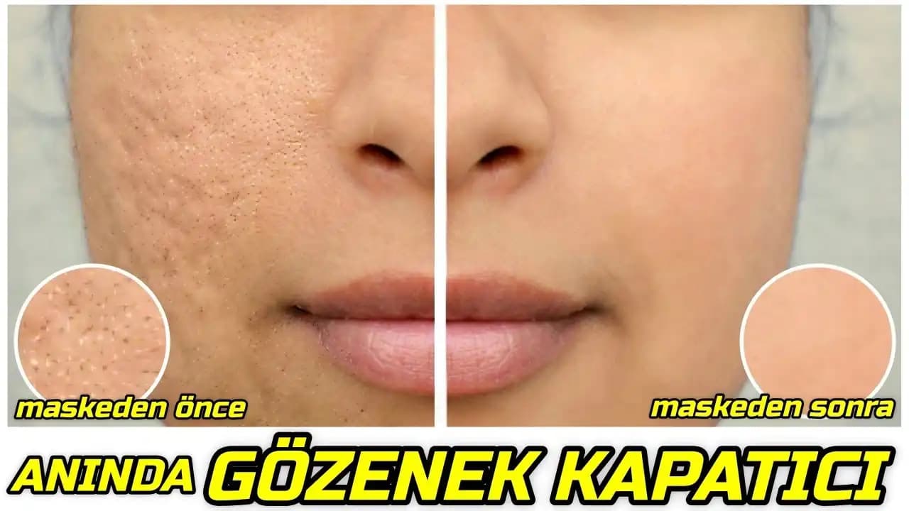Gözenekleri Küçültme Yöntemleri ve Cilt Güzelliği İçin Etkili Tavsiyeler