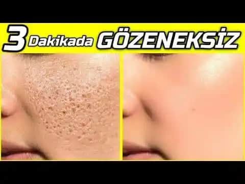 Gözenekleri Yok Etme ve Küçültme Yöntemleri: Doğal ve Profesyonel Cilt Bakımı İpuçları