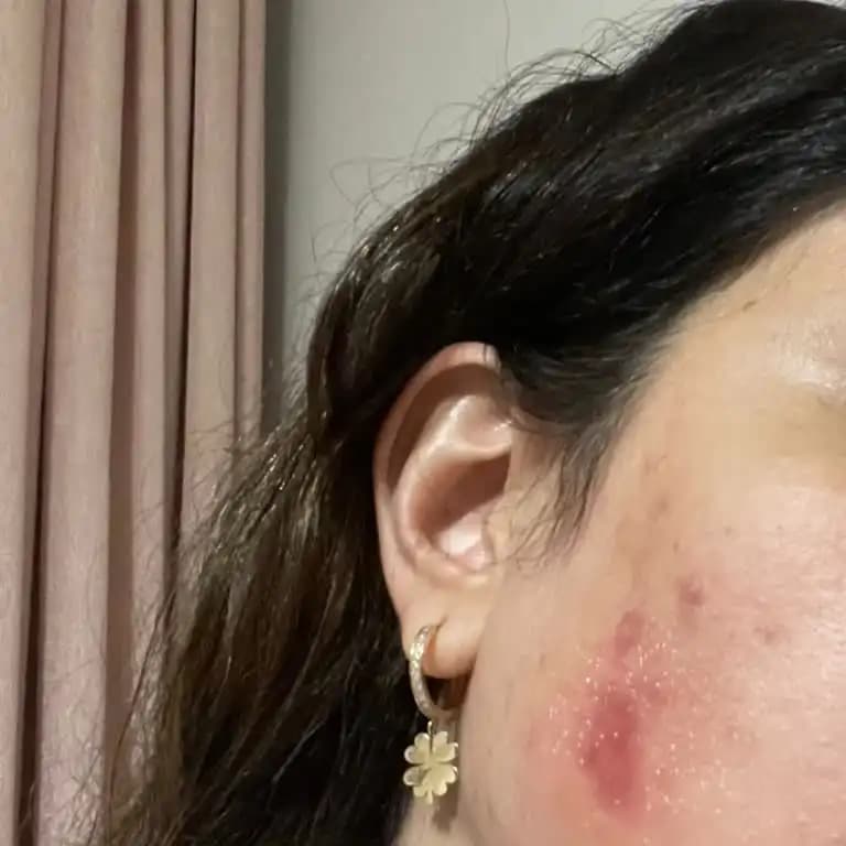 Gül Suyu: Doğal Güzellik ve Cilt Bakımında Temel Rolü ve Kullanım Alanları