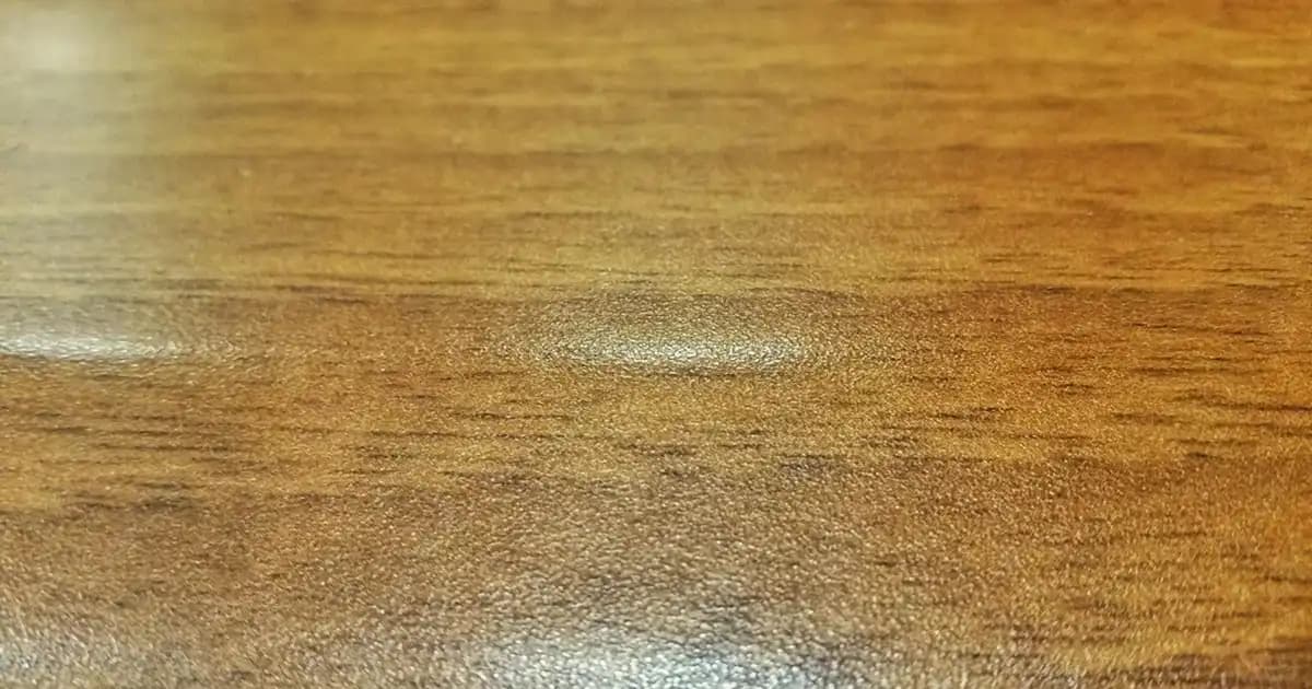Güneş Alerjisi ve Sivilce: Cilt Sağlığını Koruma Yöntemleri ve Uyarılar