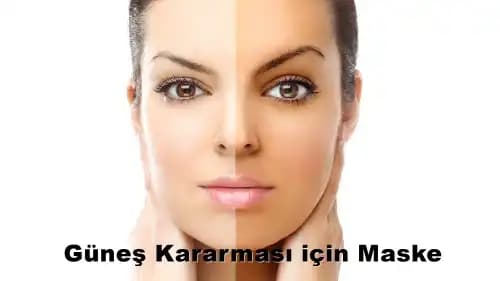 Güneş Yanığı Kararması Nasıl Geçer Cilt Sağlığı İçin Bilmeniz Gerekenler