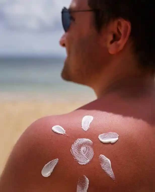 Güneş Yanığı Kızarıklığı ve Etkili Bakım Yöntemleri Hakkında Bilmeniz Gerekenler