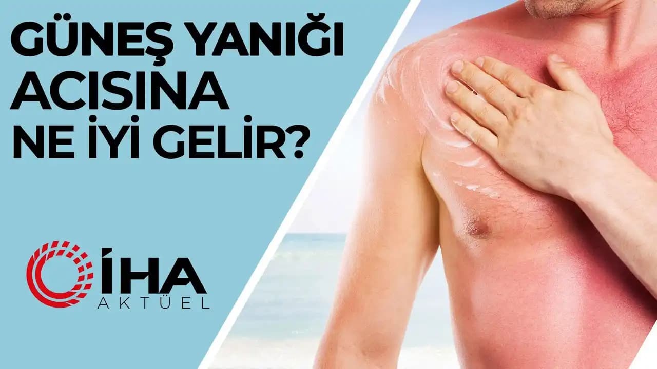 Güneş Yanığına Karşı Etkili Doğal ve Kozmetik Çözümlerle Cilt Sağlığınızı Koruyun