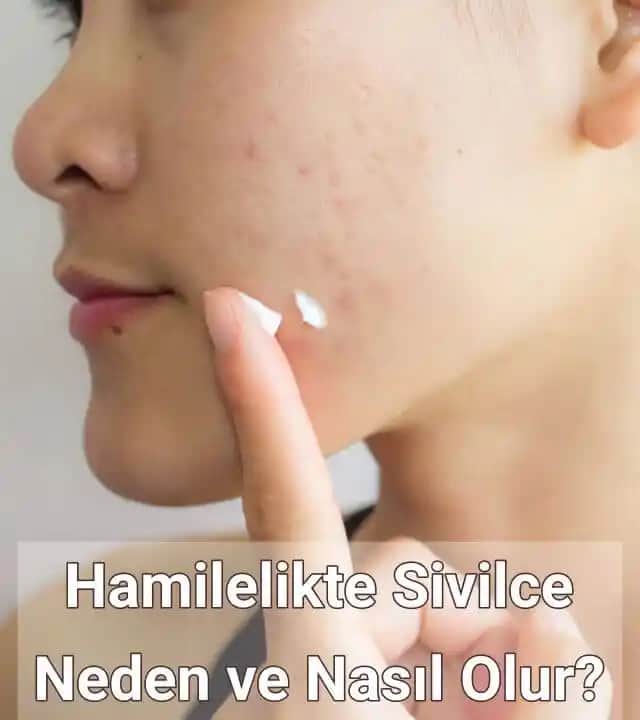 Hamilelikte Sivilce Nedenleri ve Ciltteki Değişimlerin Anlaşılması