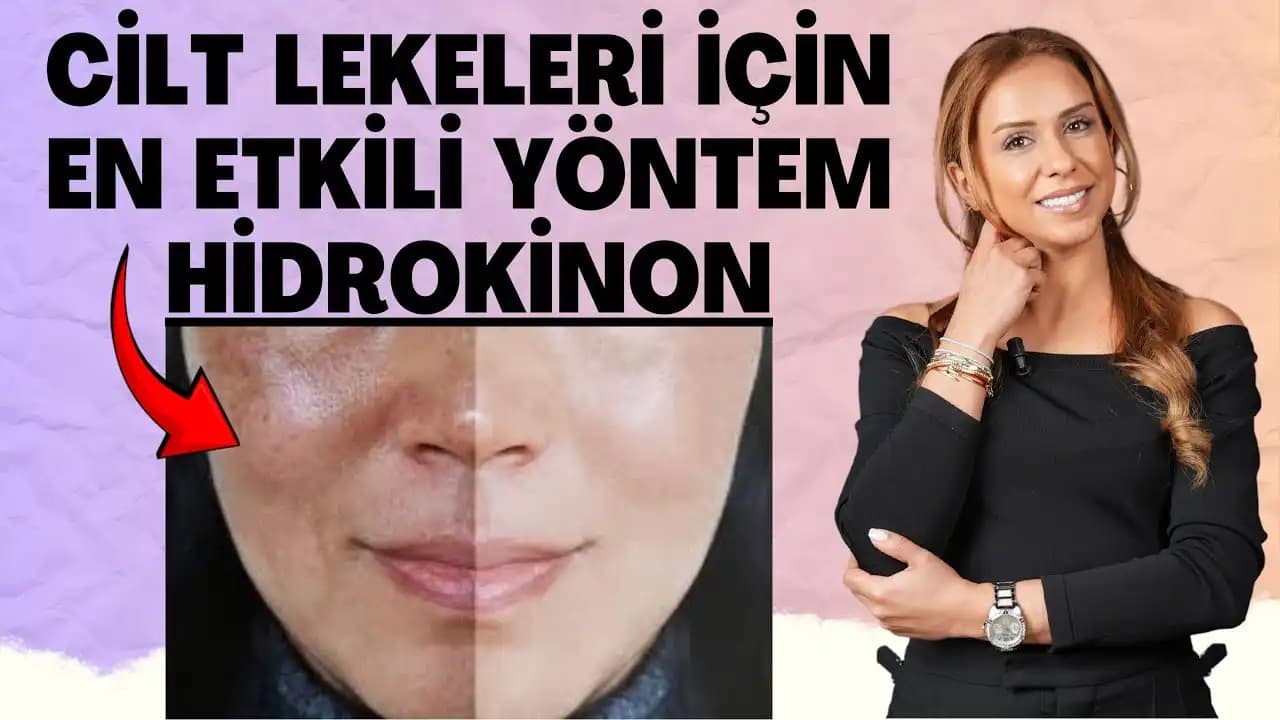Hidrokinonun Cilt Sağlığı ve Güzellik Üzerindeki Etkileri Detaylı İnceleme