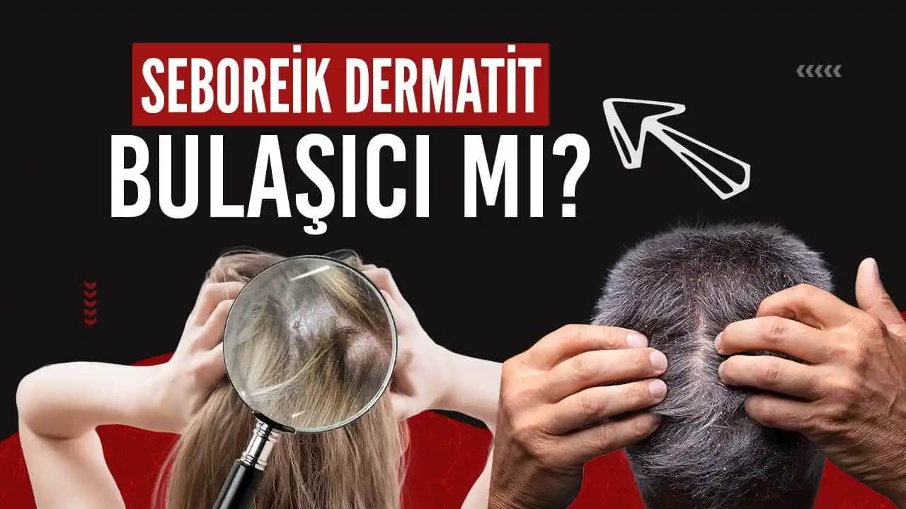 Kafa Kasılmasının Kozmetik ve Sağlık Üzerindeki Etkileri ve Önleme Yöntemleri