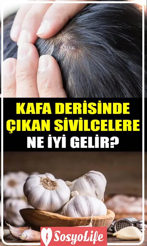Kafa Yaralarına Yönelik Etkili Bakım ve İyileşme Yöntemleri Rehberi