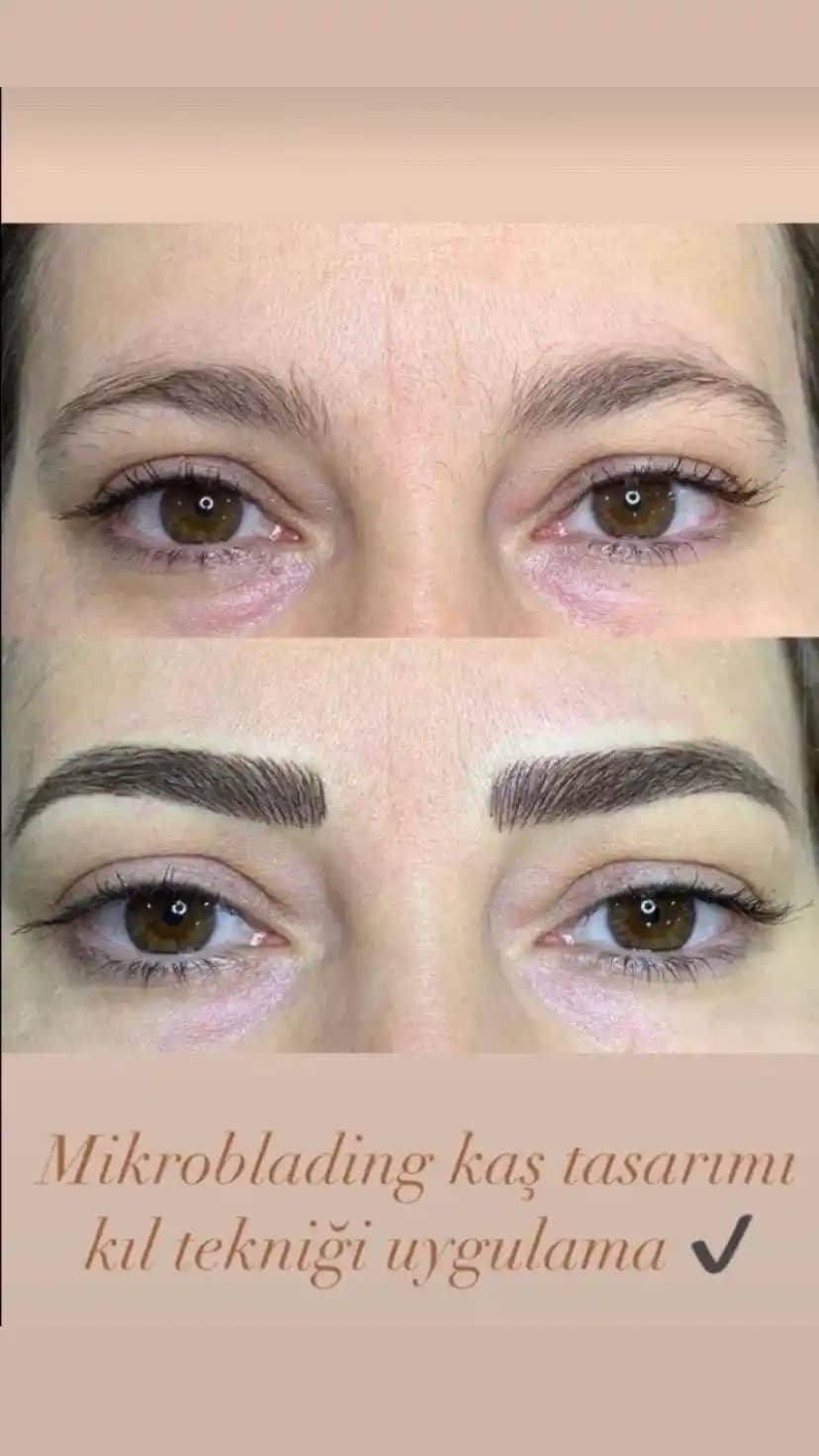Kaş Yapma Yöntemleri ve Güvenli Uygulamalar Hakkında Detaylı Bilgi