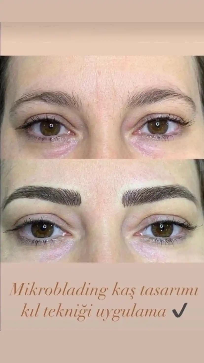 Kaş Yapma Yöntemleri ve Güvenli Uygulamalar Hakkında Detaylı Bilgi