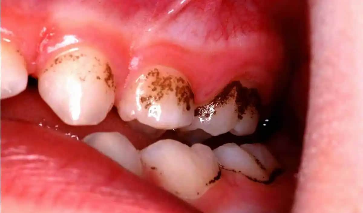 Kasık Bölgesinde Siyah Lekeler ve Çözüm Yolları: Kozmetik ve Profesyonel Yaklaşımlar