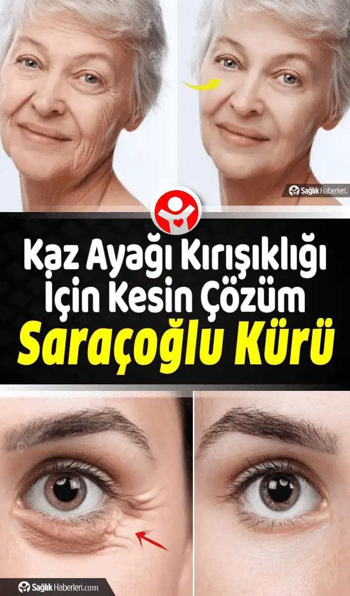 Kaz Ayağı Kırışıklıklarını Azaltan Doğal Yöntemler ve Cilt Sağlığı İpuçları