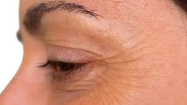 Kaz Ayaklarına Karşı Etkili Çözüm Yolları ve Güzellik Sırları