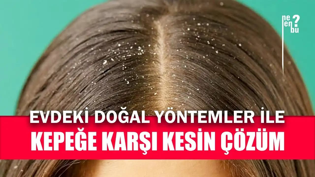 Kepek Nasıl Geçer Saç Sağlığını Koruyan Etkili Yöntemler ve Tavsiyeler