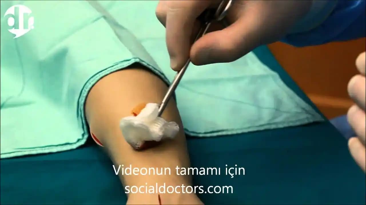 Kese Atmanın Kozmetikteki Yeri ve Doğru Uygulama Yöntemleri Hakkında Bilgi