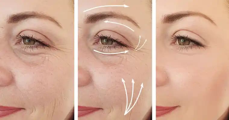 Kırışıklarla Mücadele Yöntemleri ve Cilt Sağlığını Koruma Rehberi