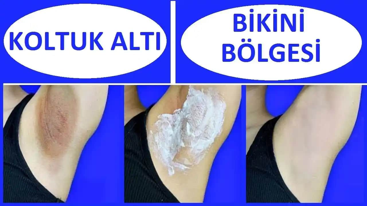 Kol Beyazlatma Yöntemleri ve Estetik Amaçlar İçin Güncel Uygulamalar