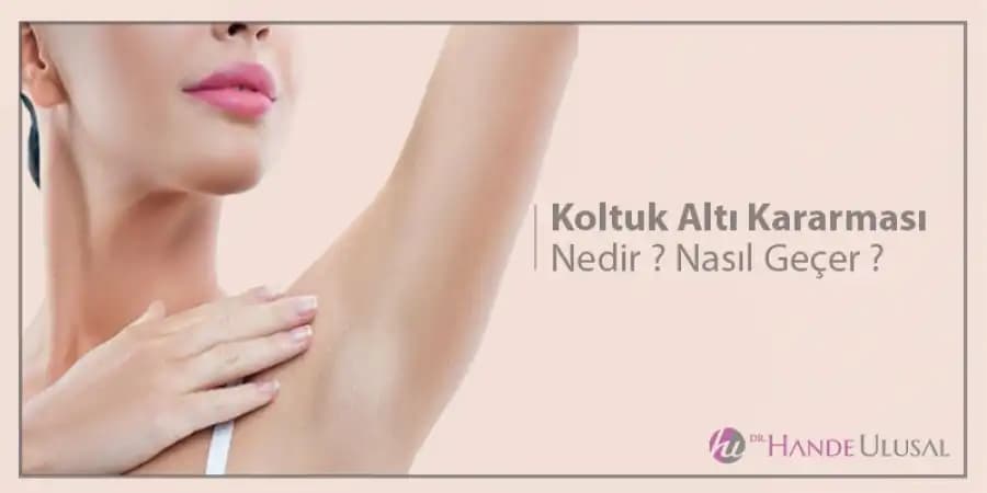 Kol Kararması Nasıl Geçer? Etkili Bakım ve Doğal Çözüm Yöntemleri