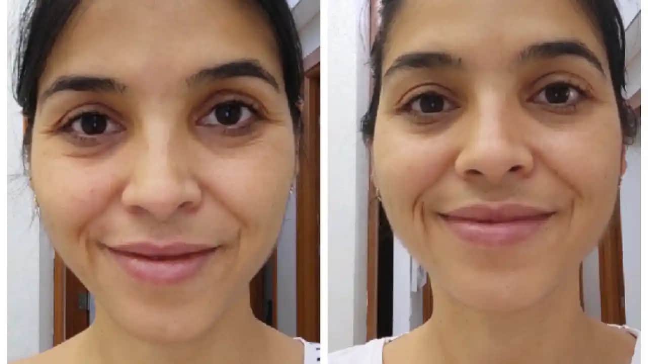 Kolajen Kullanımı Öncesi ve Sonrası: Cilt Güzelliği İçin Bilmeniz Gerekenler