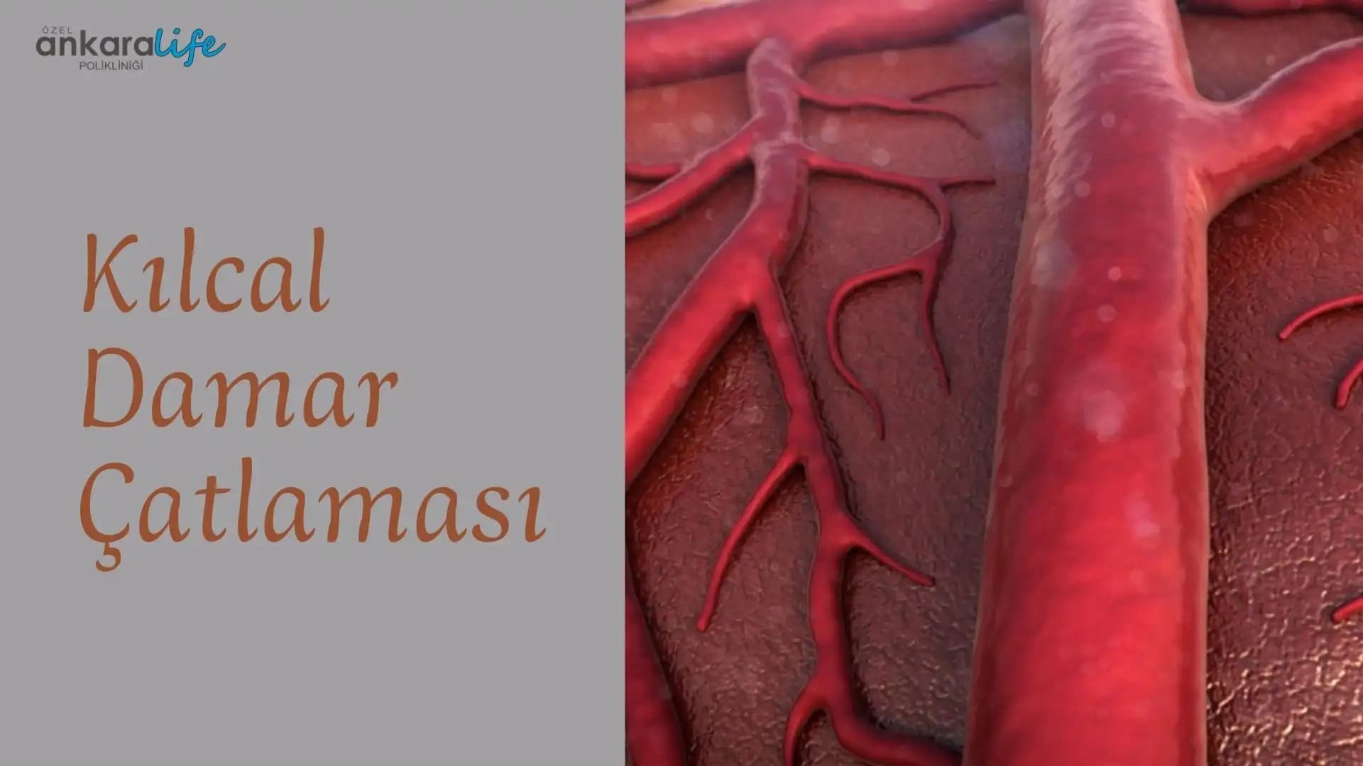Kolda Kılcal Damar Çatlaması Nedenleri Belirtileri ve Kozmetik Tedavi Yöntemleri