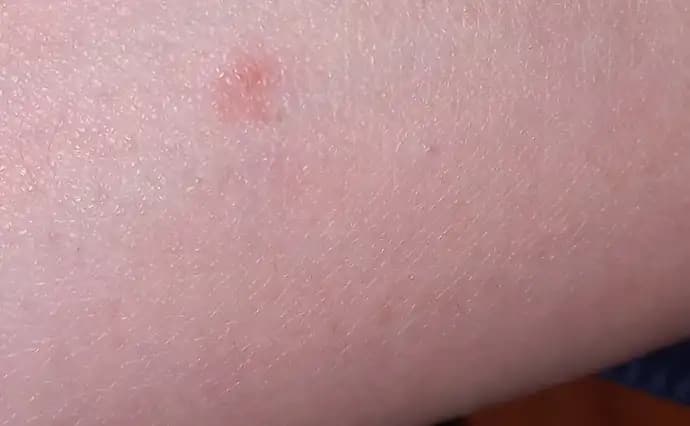 Kolda Yeşil Leke Nedenleri, Çözümleri ve Koruyucu Yöntemler Hakkında Detaylı Bilgi