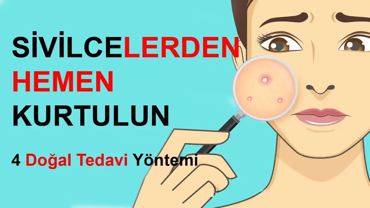 Koldaki Sivilcelere Karşı Etkili Çözüm Yöntemleri ve Doğal Bakım İpuçları
