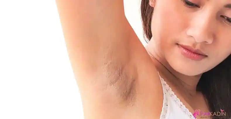 Koltuk Altı Kararması Nedenleri ve Kalıcı Çözüm Yolları Hakkında Detaylı Bilgi