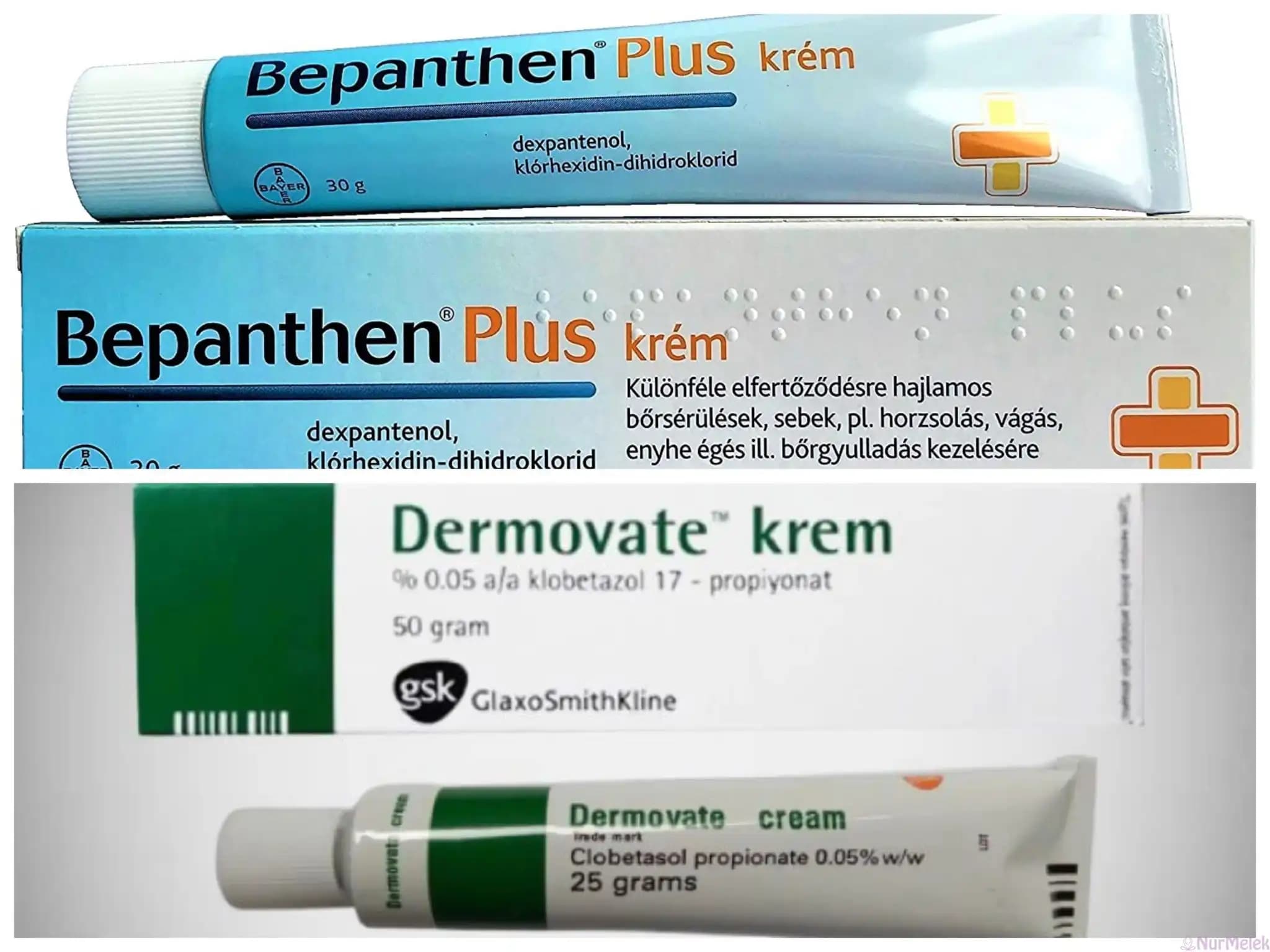 Kortizonlu Sedef Kremleri: Etkileri, Kullanımı ve Dikkat Edilmesi Gerekenler