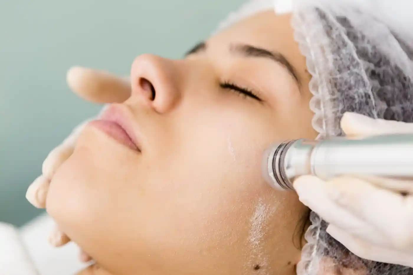 Kristal Peeling Nedir ve Cilt Yenileme İçin Neden Tercih Edilir