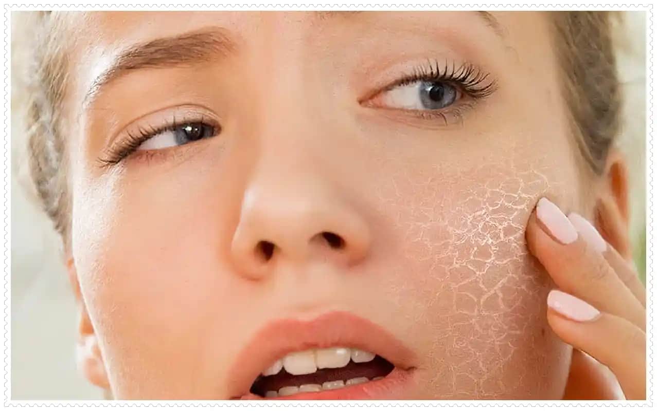 Kuru Cilt Belirtileri ve Doğru Bakım Yöntemleri Hakkında Kapsamlı Rehber