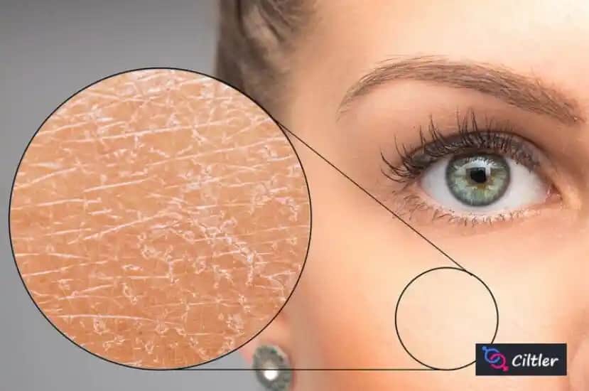 Kuru Ciltler İçin Günlük Nem ve Sağlık Odaklı Bakım Rehberi