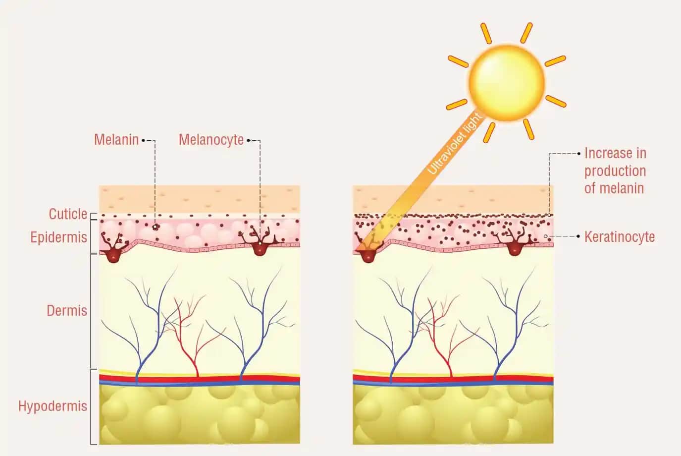 Melanin Hiperpigmentasyonu ve Cilt Sağlığını Koruma Yöntemleri