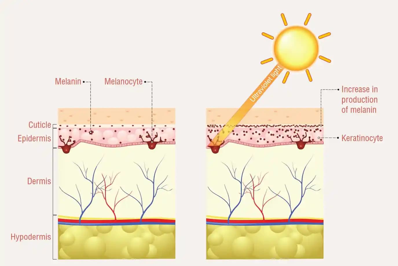 Melanin Hiperpigmentasyonu ve Cilt Sağlığını Koruma Yöntemleri