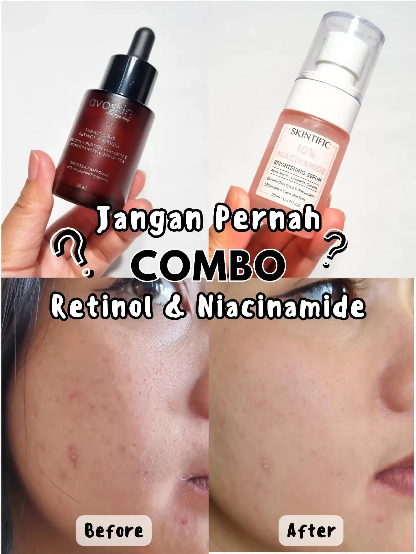 Niacinamide ve Retinol Kullanımı: Cilt Bakımında Güçlü ve Güvenli Bir Kombinasyon
