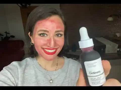 Ordinary Kırmızı Peeling ile Cilt Sağlığını Destekleyen Etkili Bakım Yöntemi