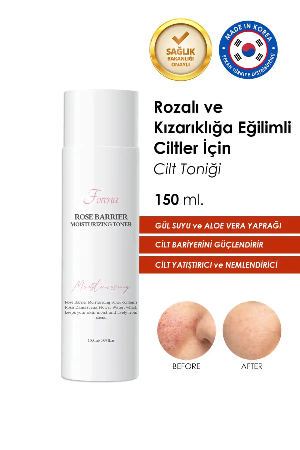 Rozalı Ciltler İçin Uygun Tonik Seçenekleri ve Doğal Tarifler Rehberi