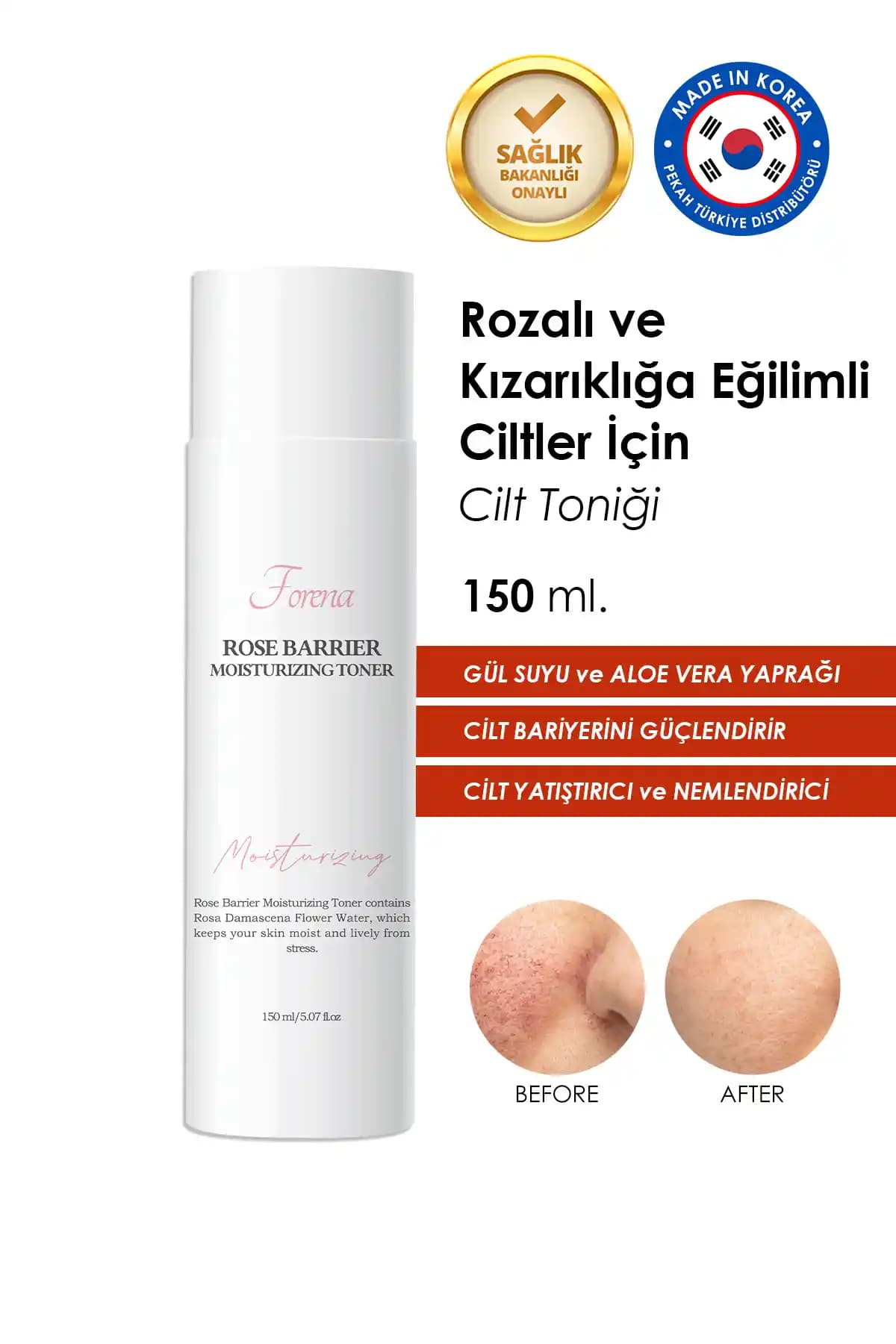 Rozalı Ciltler İçin Uygun Tonik Seçenekleri ve Doğal Tarifler Rehberi