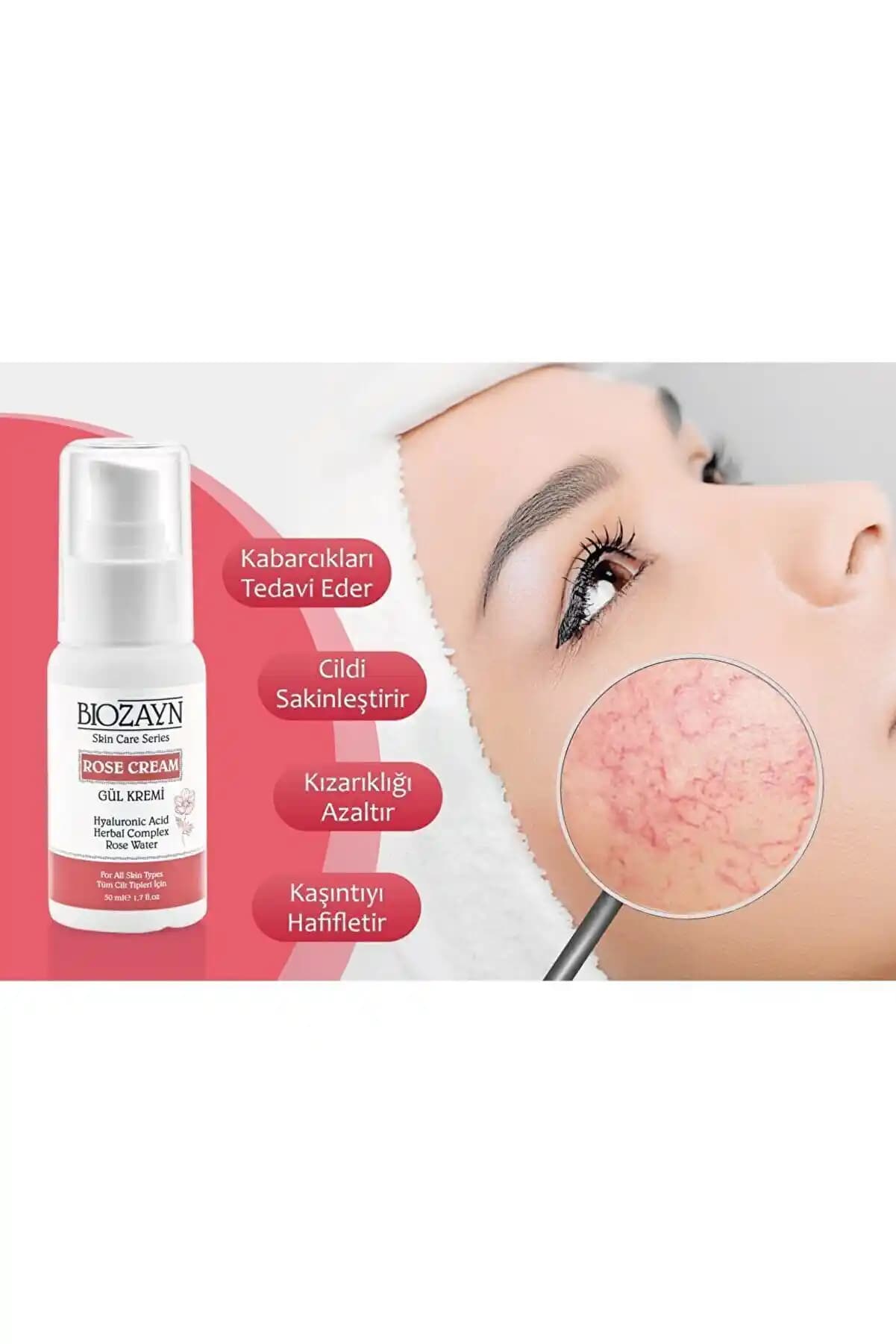 Rozasea Gül Hastalığına Karşı Doğru Krem Seçimi ve Cilt Sağlığı Rehberi