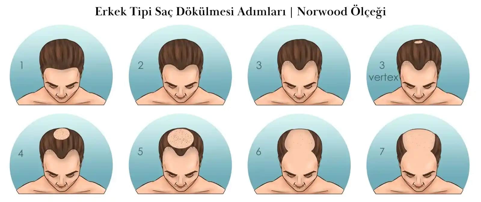 Saç Deri Dökülmesi Nedenleri ve Korunma Yöntemleri Hakkında Detaylı Bilgi