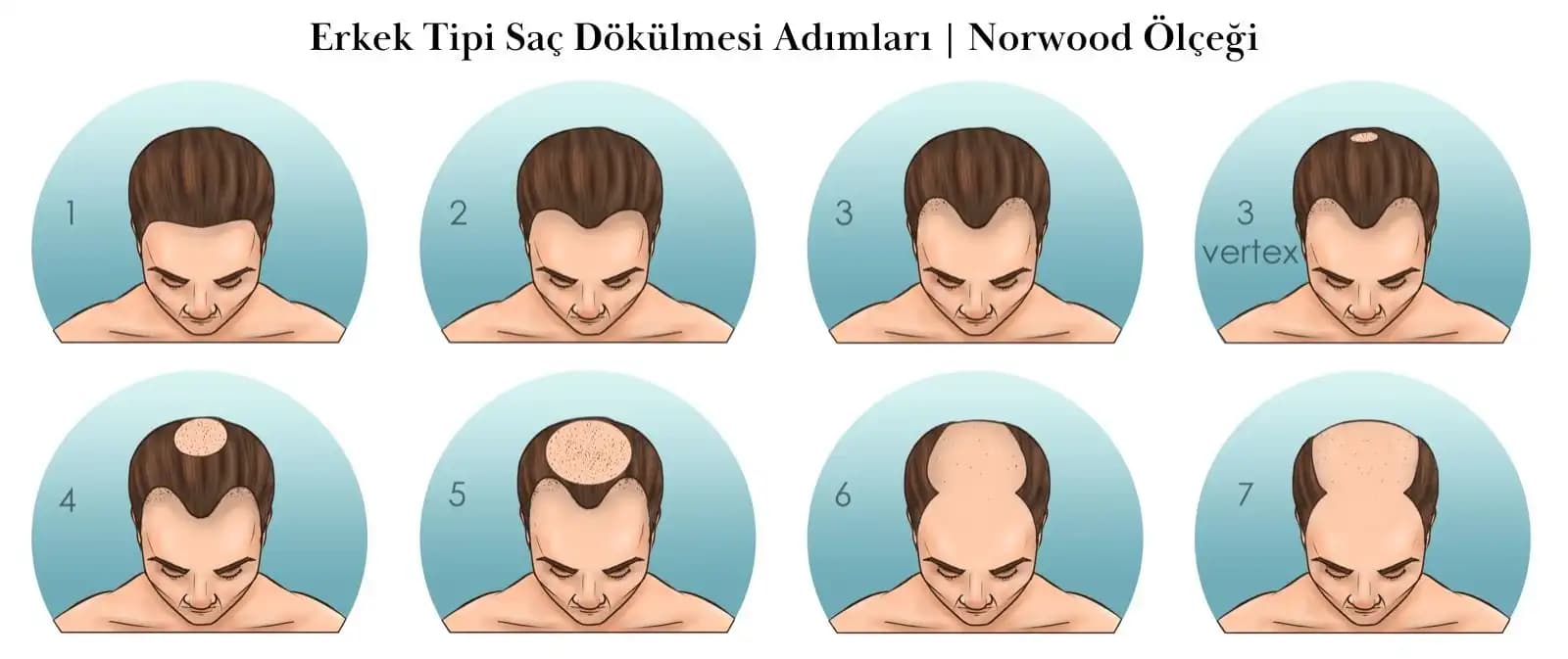 Saç Deri Dökülmesi Nedenleri ve Korunma Yöntemleri Hakkında Detaylı Bilgi