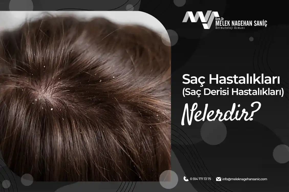 Saç Derisi Ağrısının Nedenleri ve Etkili Kozmetik Çözümler