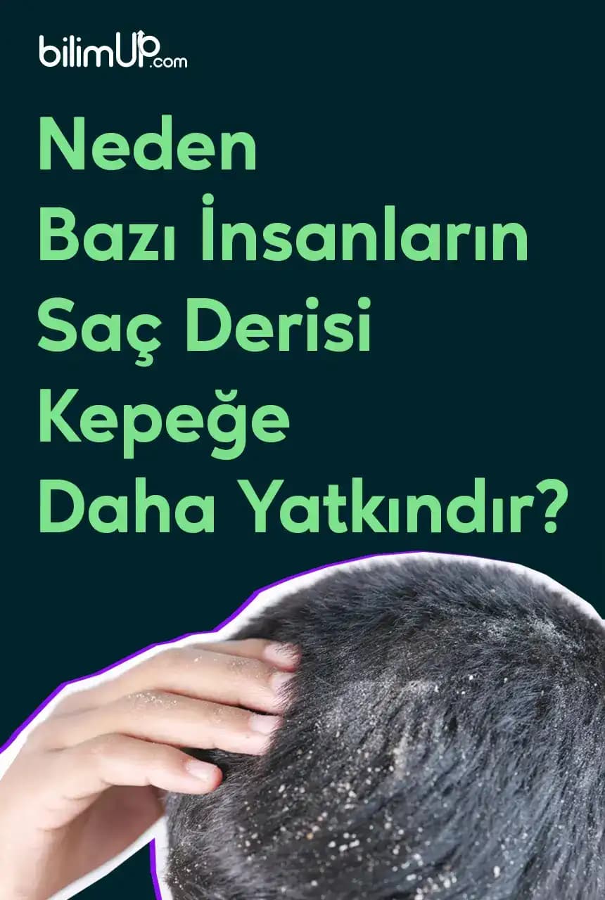 Saç Derisi Kavlaması Nedenleri Belirtileri ve Etkili Çözüm Yolları