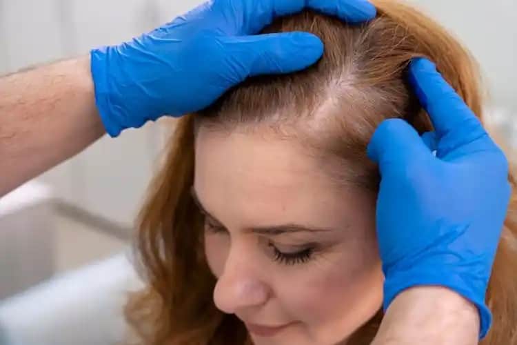 Saç Derisi Kızarmasının Nedenleri ve Etkili Tedavi Yöntemleri Hakkında Detaylı Rehber