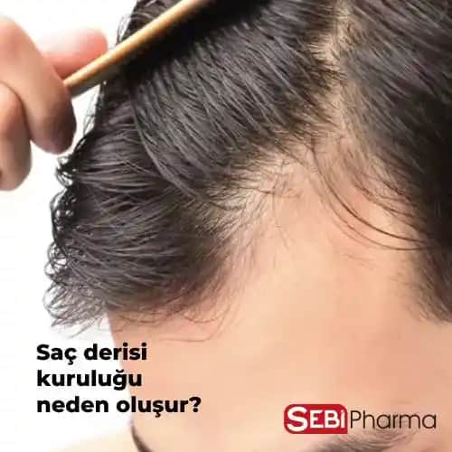 Saç Derisi Kuruluğu ve Saç Dökülmesi İlişkisi: Nedenleri ve Korunma Yolları