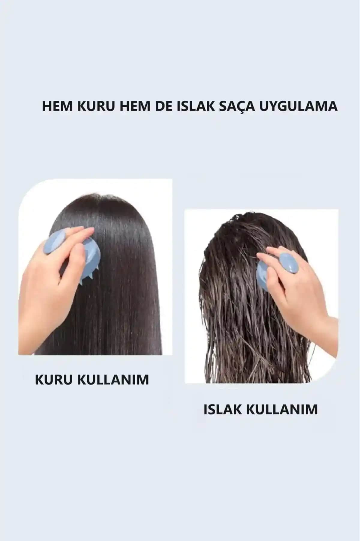 Saç Derisinde Kepek Problemi ve Doğal Çözüm Yöntemleri Hakkında Bilgilendirici Rehber