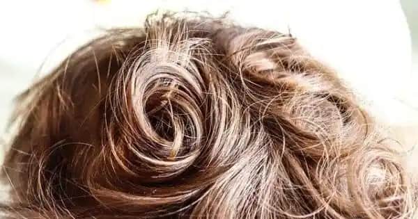 Saç Derisinin Acımasının Nedenleri ve Etkili Bakım Yöntemleri