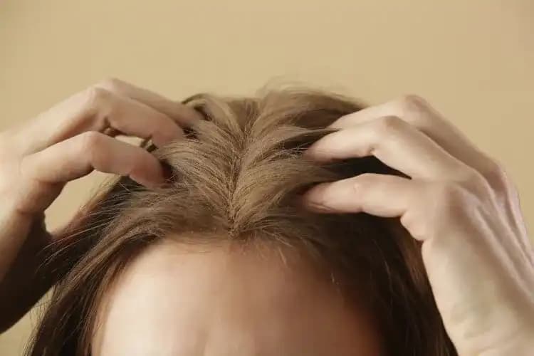 Saç Dibi Ağrısı Nedenleri, Çözümleri ve Önleyici Yöntemler Hakkında Kapsamlı Bilgi
