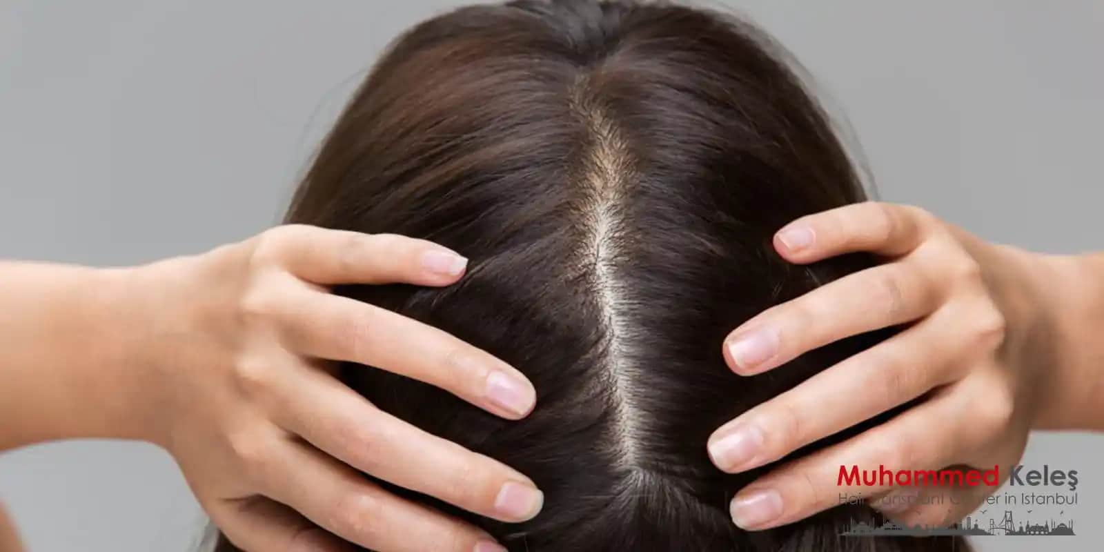 Saç Dipleri Kabuklanması Nedenleri ve Etkili Tedavi Yöntemleri