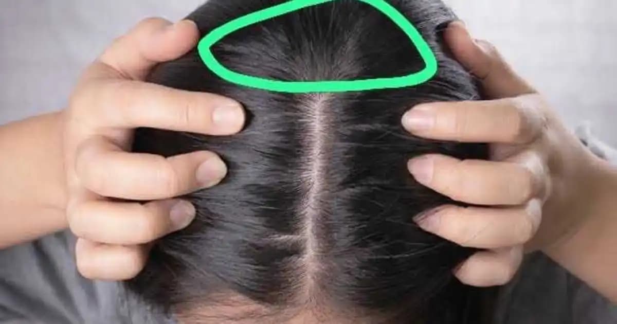 Saç Dipleriniz Neden Ağrıyor ve Bu Sorunu Nasıl Çözebilirsiniz